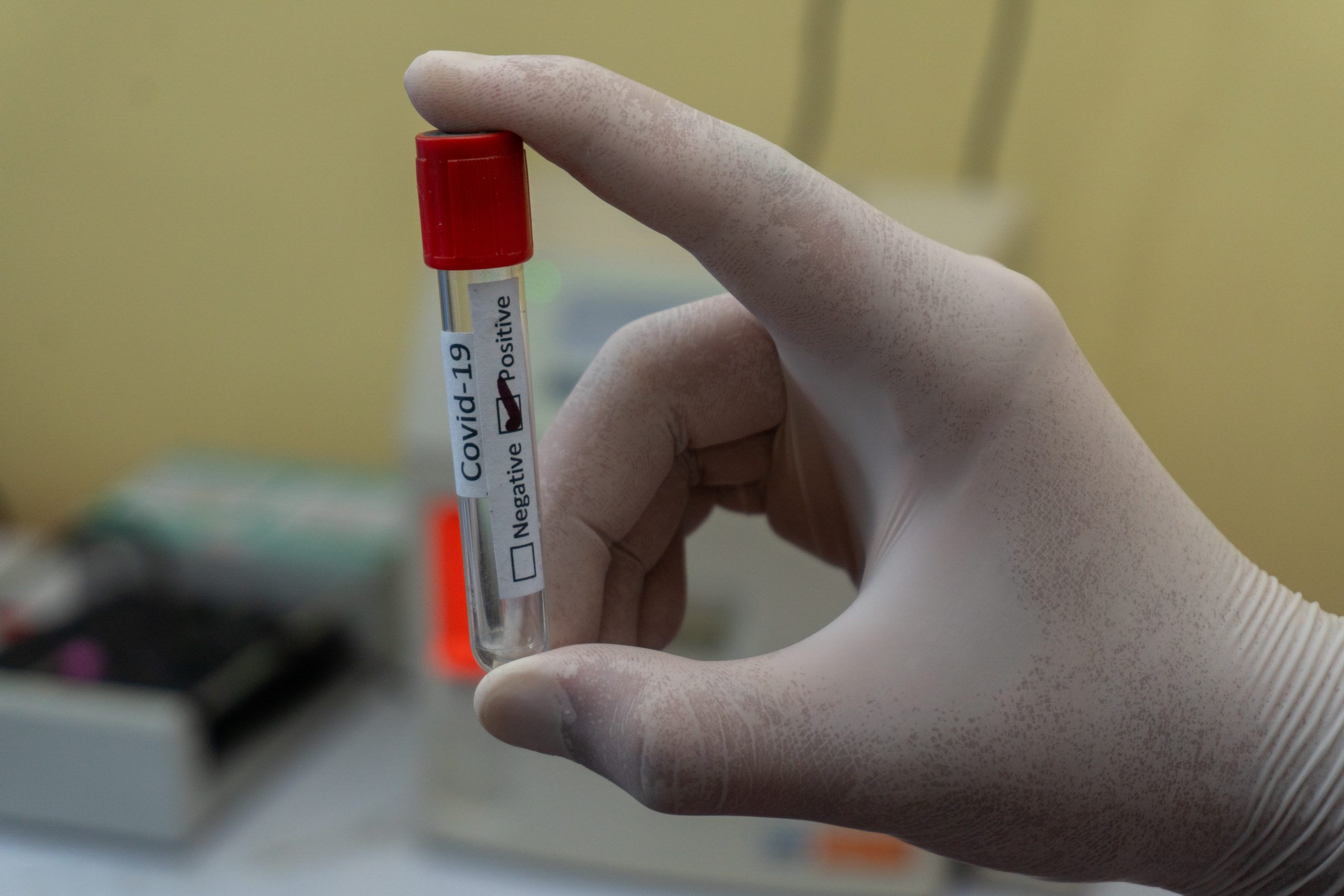 First Documented Case of COVID Reinfection in Hong Kong